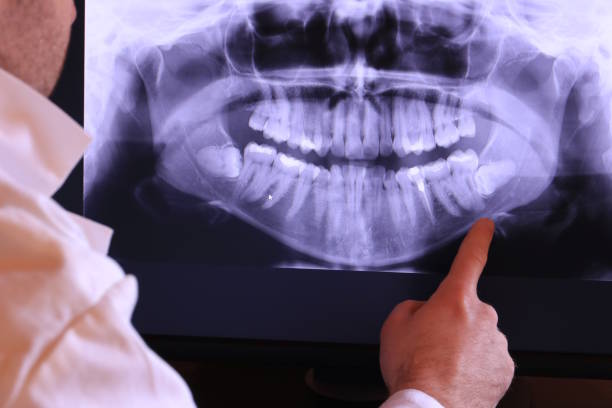 Best Knocked-Out Tooth Emergency  in Waverly, MN