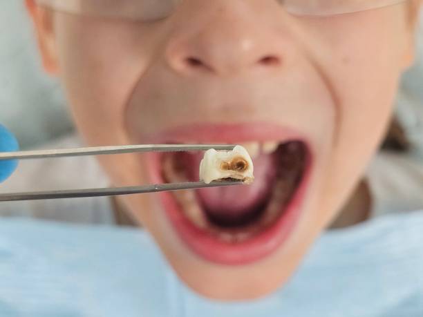 Best Tooth Pain Emergency Relief  in Waverly, MN